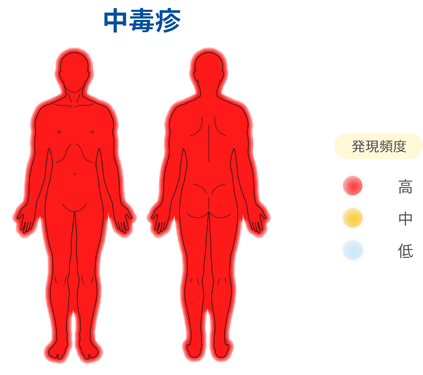 中毒疹