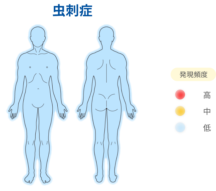 虫刺症