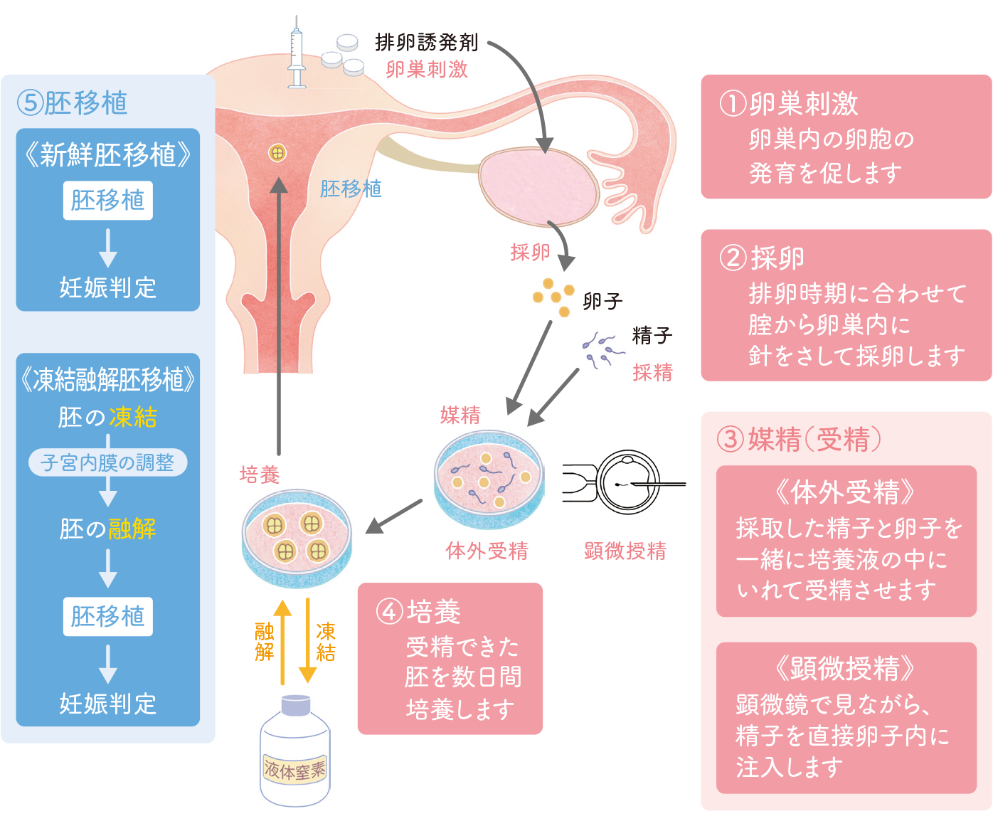 新鮮 胚 移植 と は