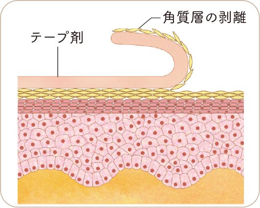 皮膚のバリア機能とテープ剤