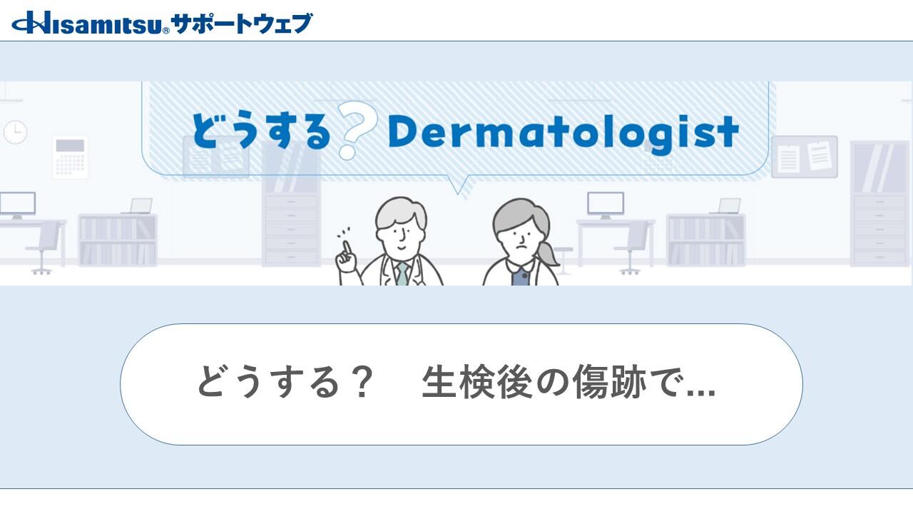どうする？Dermatologist