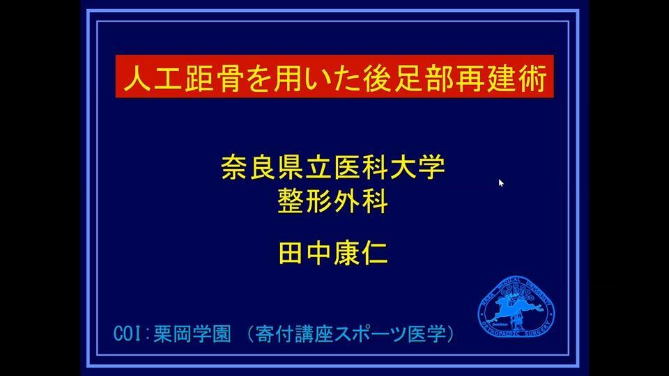 激安先着 [A11548801]整形外科の手術手技―私はこうしている (別冊整形