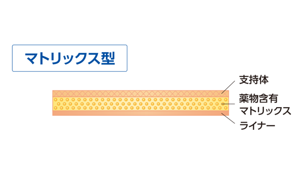 マトリックス型