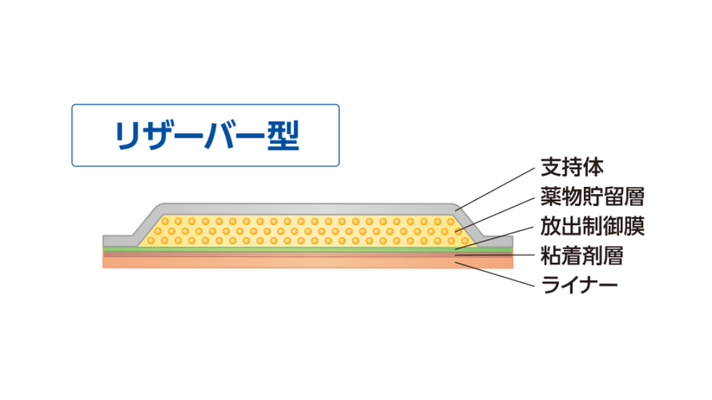 リザーバー型